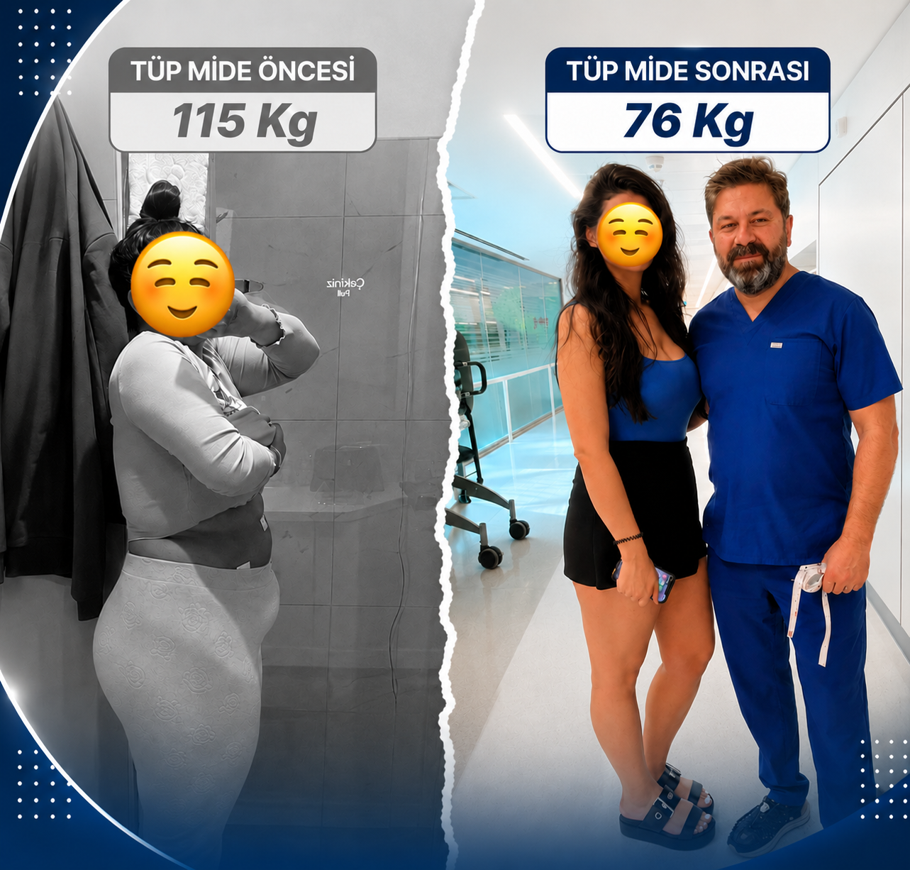 tup-mide-ameliyati-oncesi-sonrasi-013 Ana Sayfa